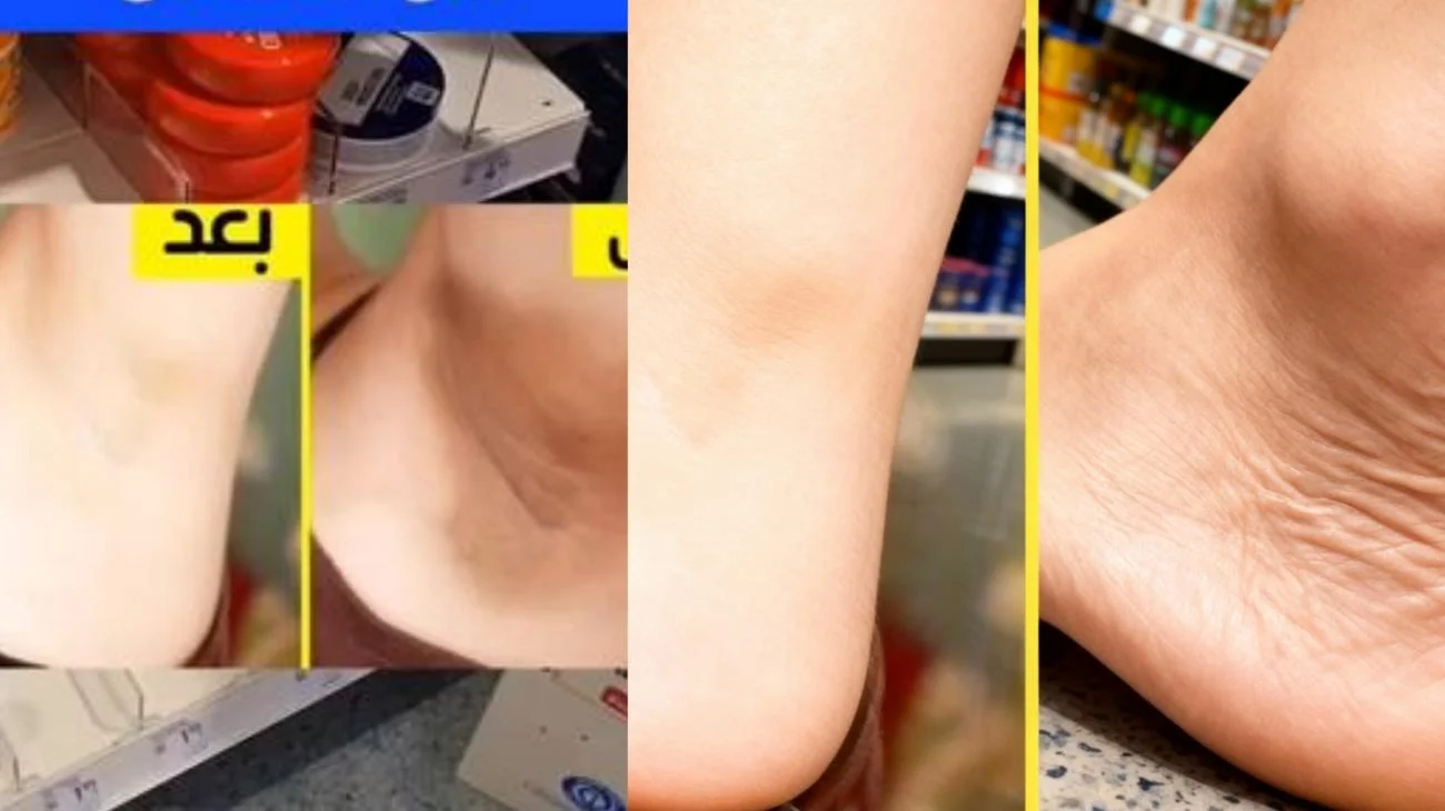 DM#fyp #foryou #videoviral #100kview #viraltiktok"